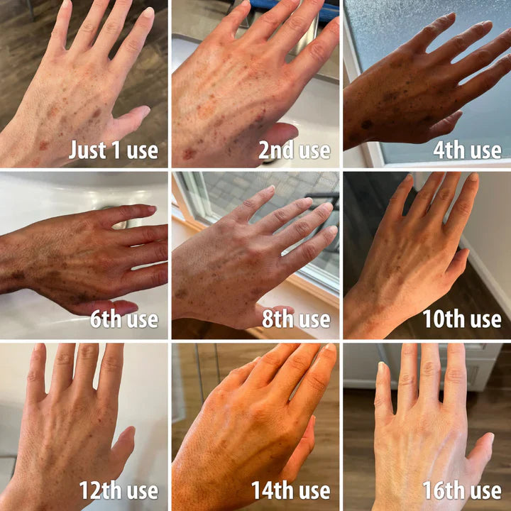 Dark Spot Correcting Glow Serum