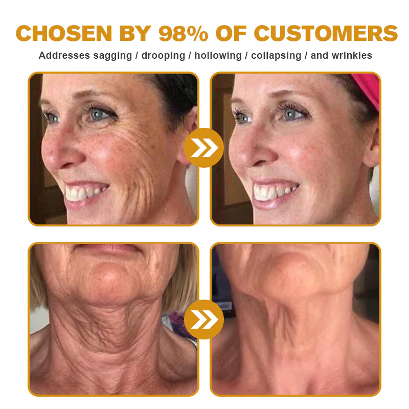 👨‍⚕️ Made and Shipped from US✅  Tlopa® Bee Venom Multi-Symptom Skin Treatment Cream