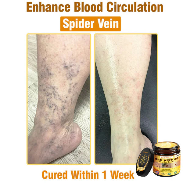 Bee Venom All-in-One Cream US Dermatologist Approved