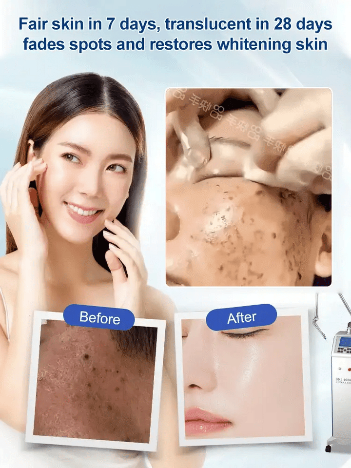 🔥Last Day Buy 1 Get 1 Free-Spot Fading Urea Cream