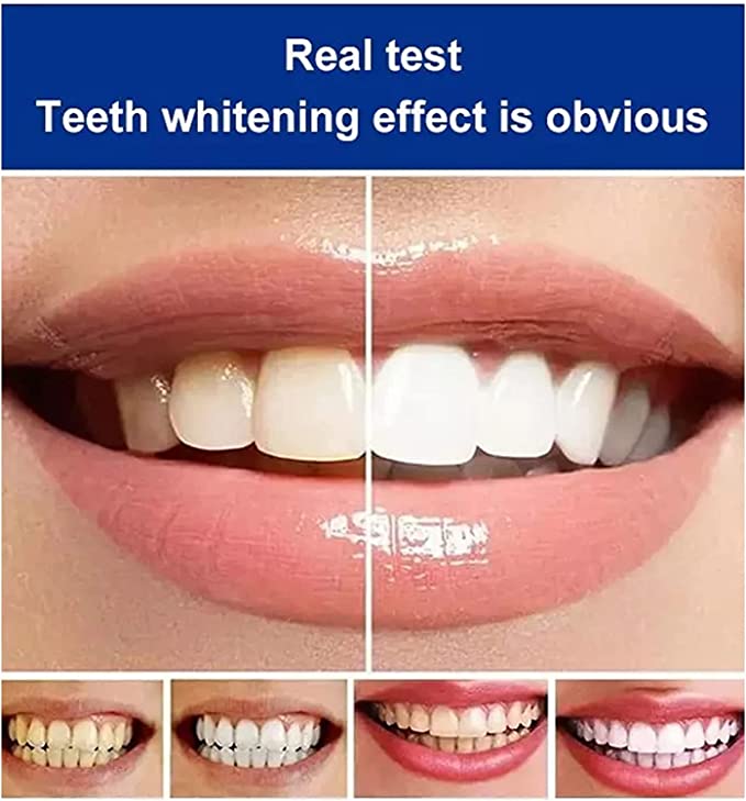 Brightening & Stain Removing Probiotic Toothpaste