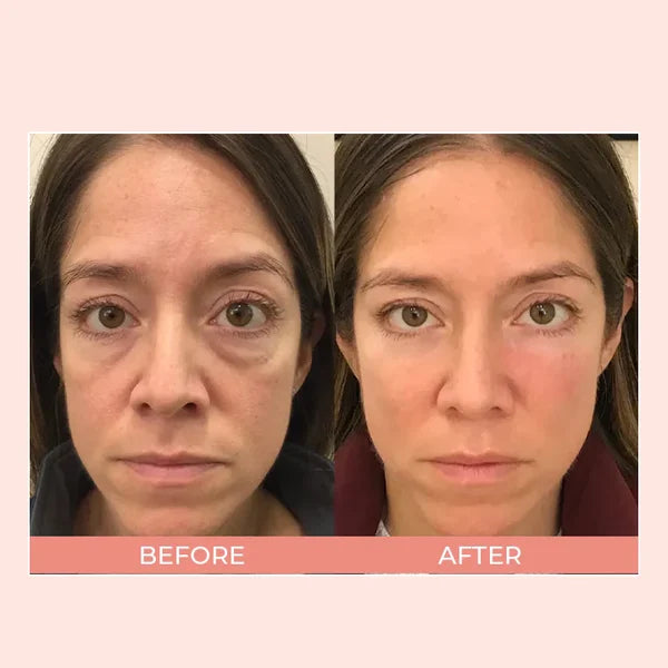 EIASER™ Retinol Polypeptide Repair Eye Cream