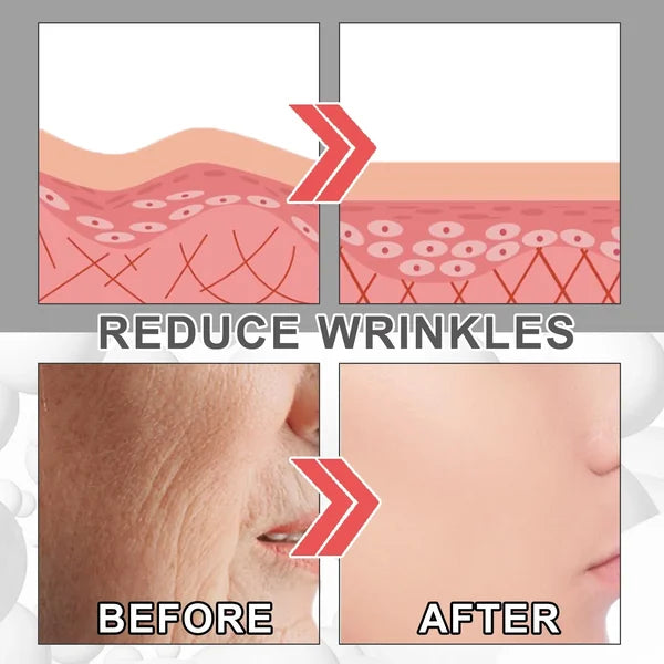 Last Day Promotion 49% OFF--2024 New Collagen Boost Anti-Aging Serum