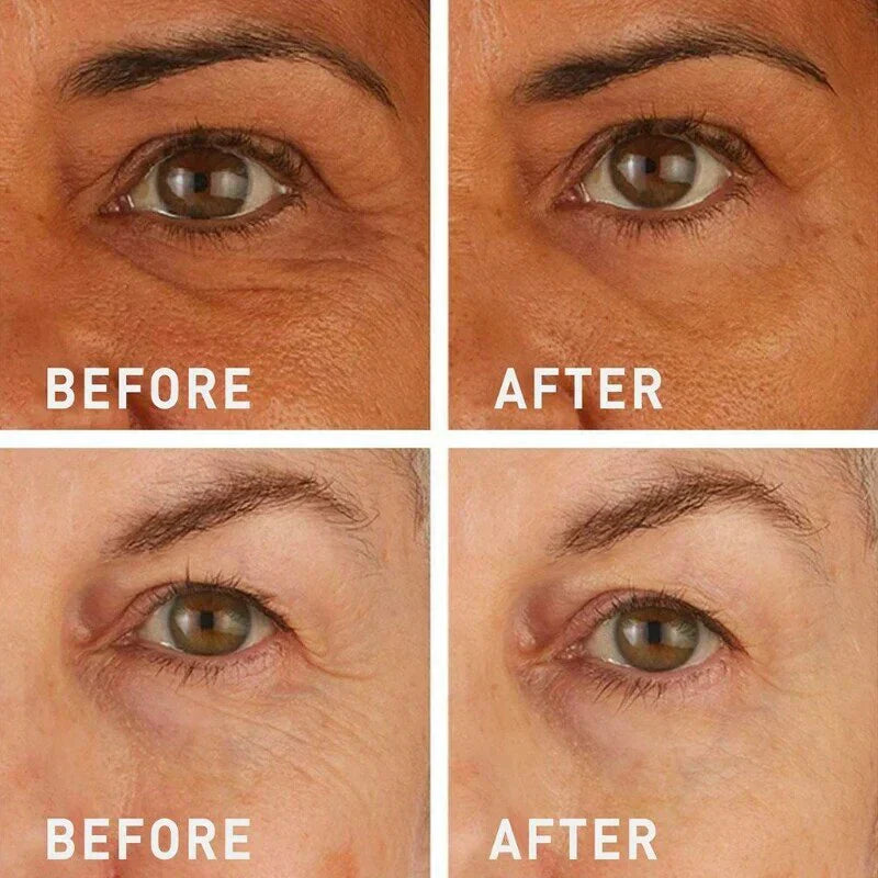 🚨𝑳𝑨𝑺𝑻 𝑫𝑨𝒀 𝑫𝑰𝑺𝑪𝑶𝑼𝑵𝑻: 𝟖𝟕% 𝑶𝑭𝑭 🔥 Instant Wrinkle Eye Tightener Cream