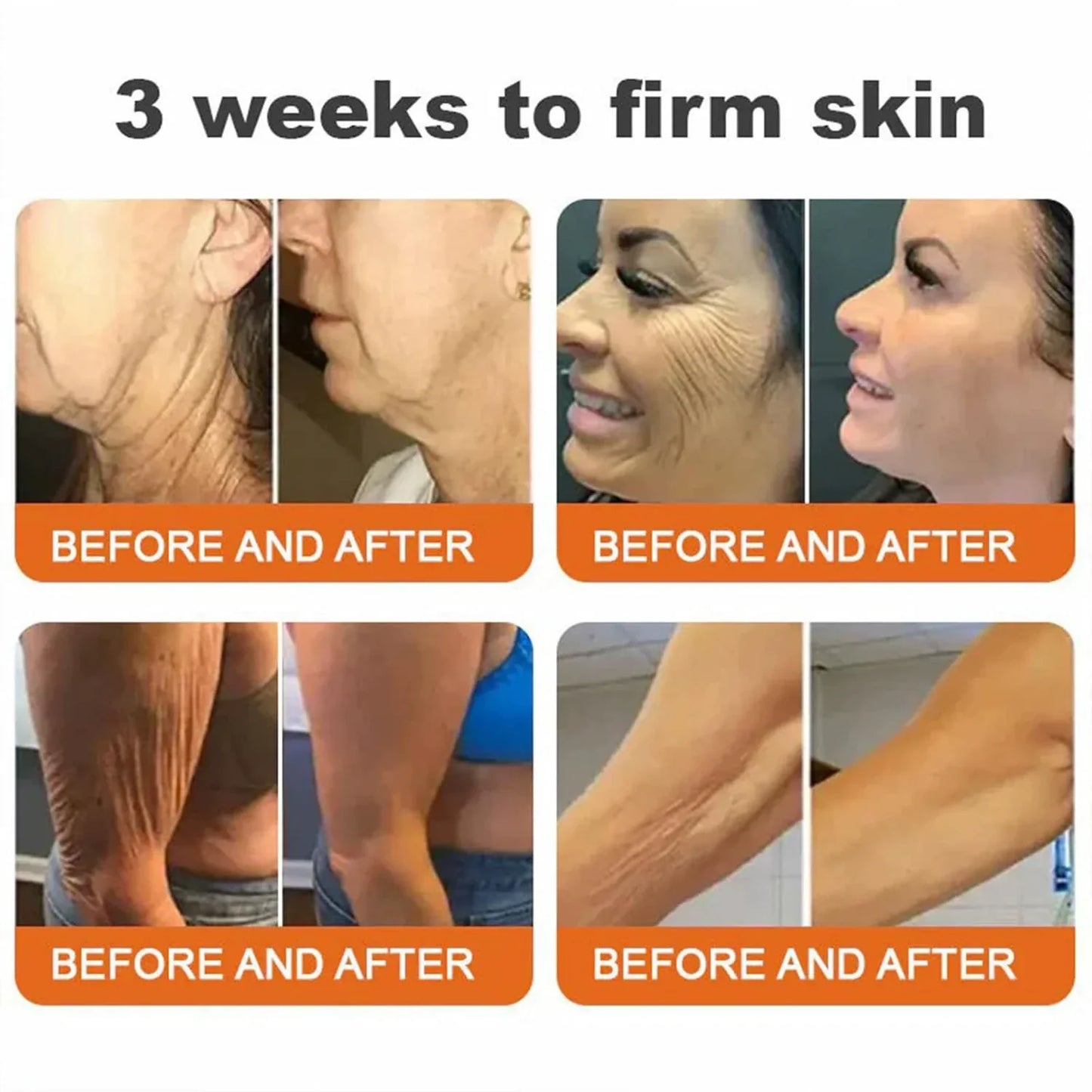 👨‍⚕️ Made and Shipped from US✅  Tlopa® Bee Venom Multi-Symptom Skin Treatment Cream