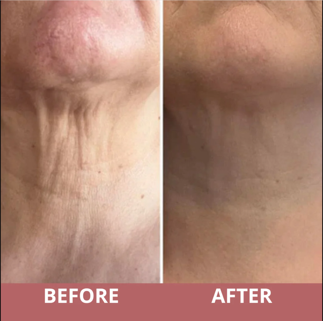 TIGHTEN & LIFT NECK CREAM by CocoBeauty
