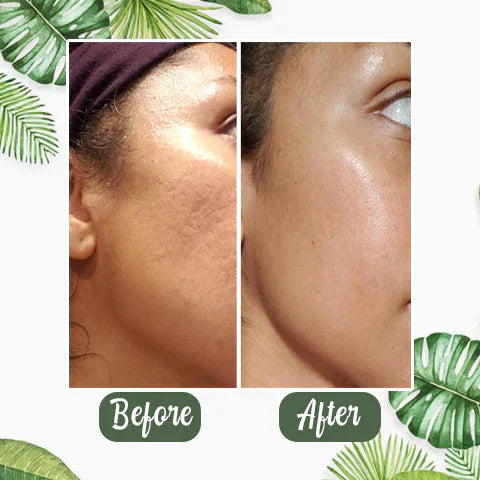 MatchaGlow™ – Clarifying Face Mask