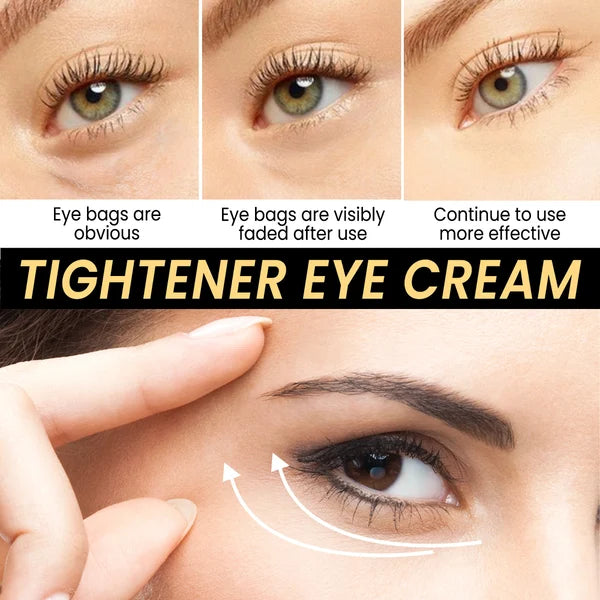 🎁Last Day 50% SALE OFF - Fast Firming Eye Cream🔥